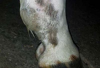 Μόλυνση των ποδιών 250ml