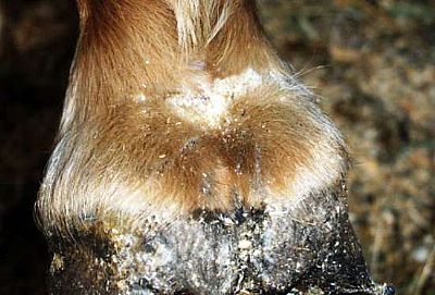 Μόλυνση των ποδιών 250ml